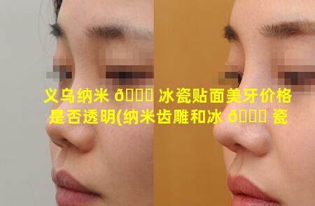 义乌纳米 💐 冰瓷贴面美牙价格是否透明(纳米齿雕和冰 🐒 瓷牙贴面哪种好)